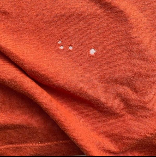 If you find these holes in your clothes, you had better know what it means